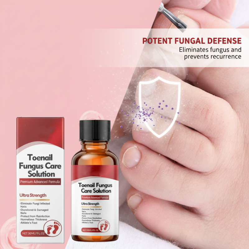 🖤See Real Results Faster🖤Nail Repair Essence for Damaged Nails💅🏻