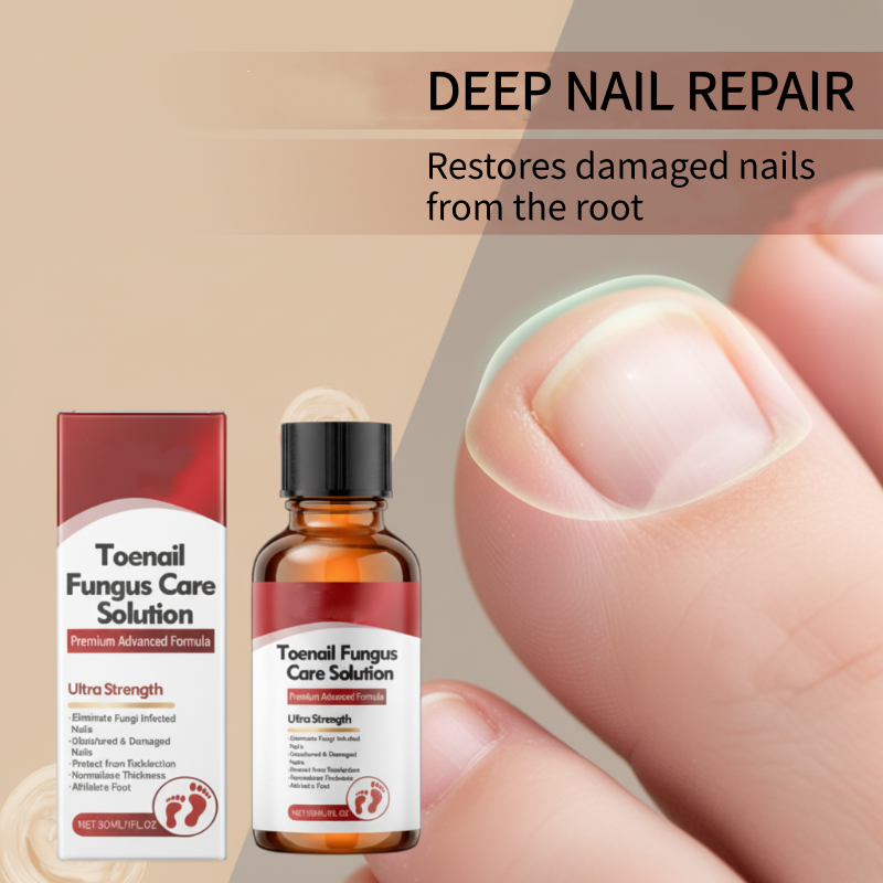 🖤See Real Results Faster🖤Nail Repair Essence for Damaged Nails💅🏻