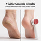 🎉 2026 Sale — Over 26,200 Sold!🦶 Double Sided Stainless Steel Foot Scraper Callus Remover ✨