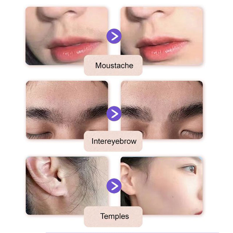 Gentle & Painless Facial Hair Removal Cream