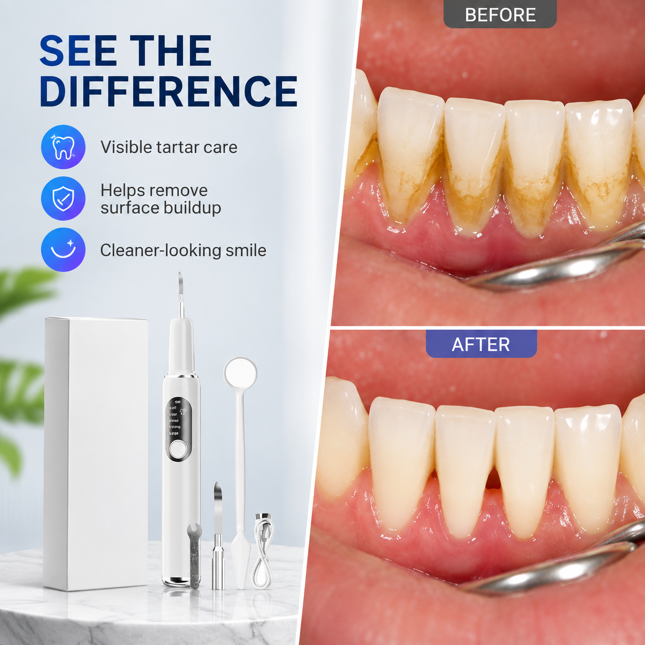 Portable Ultrasonic Teeth Cleaner and Tartar Remover Set